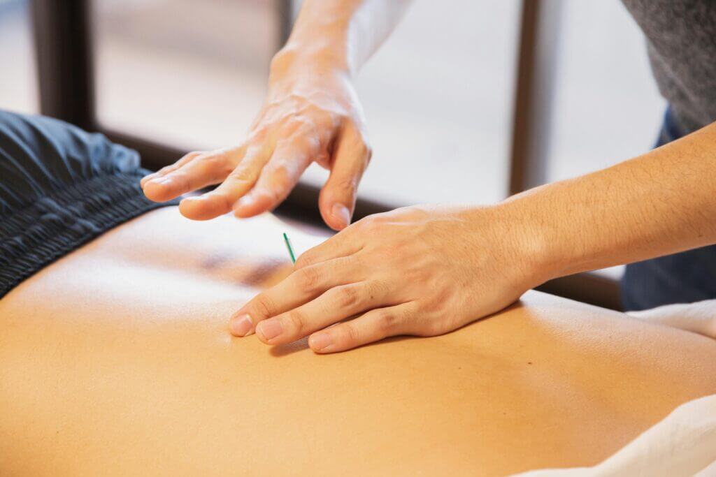 Healing Practices acupuncture therapy session in rehabilitation salon